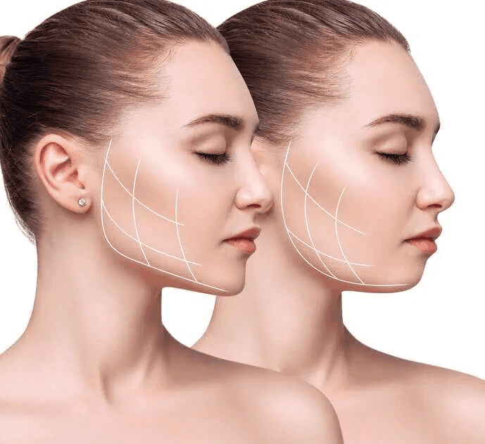 The Science Behind Endolift: How It Works to Rejuvenate Your Skin