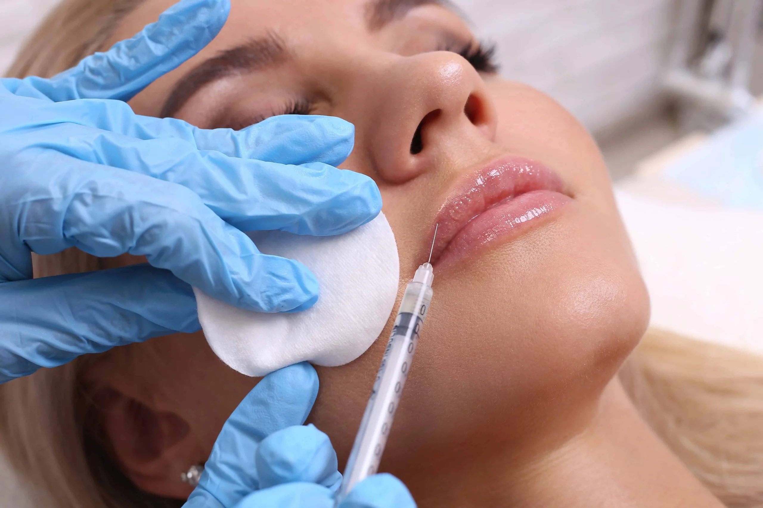 Dermal Fillers 101: What to Expect Before, During, and After Treatment