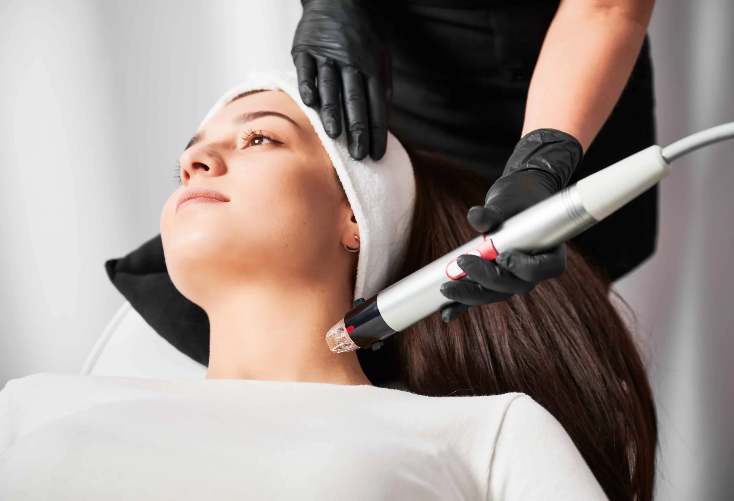 Microneedling with Radiofrequency