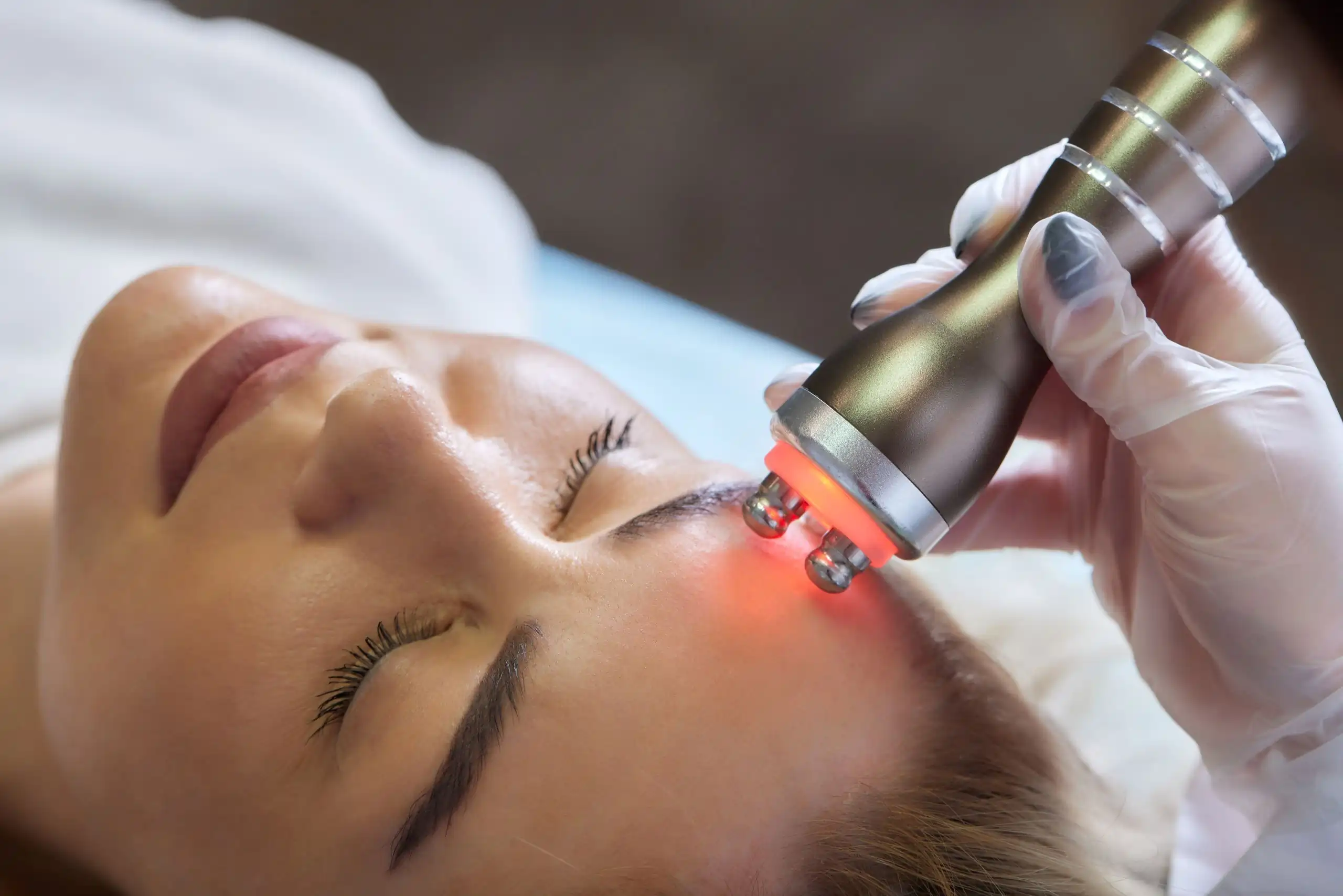 Radiofrequency Facial Contouring